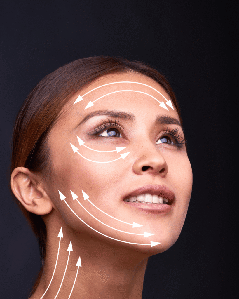 what is a perfect face lift ( 2)